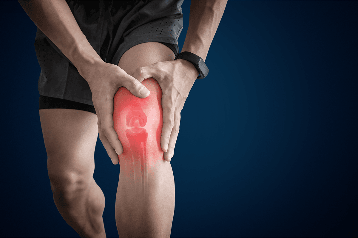 Arthritis: What It Is and How to Manage It